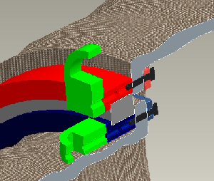 Rotational Shoulder Joint